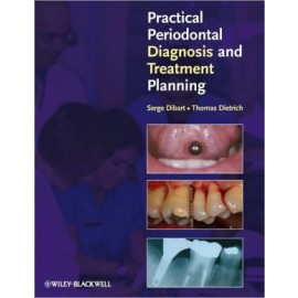 Practical Periodontal Diagnosis and Treatment Planning