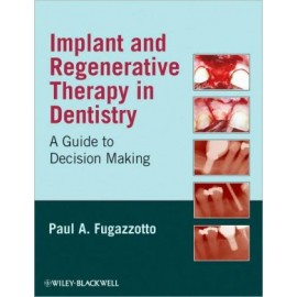 Implant and Regenerative Therapy in Dentistry: A Guide to Decision Making