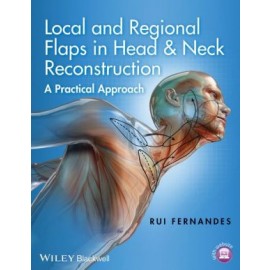 Local and Regional Flaps in Head & Neck Reconstruction: A Practical Approach