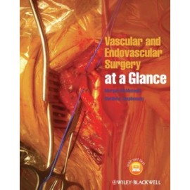Vascular and Endovascular Surgery at a Glance