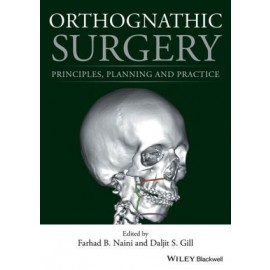 Orthognathic Surgery - Principles, Planning and Practice