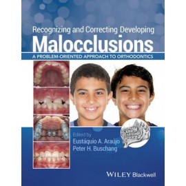 Recognizing and Correcting Developing Malocclusions: A Problem-Oriented Approach to Orthodontics