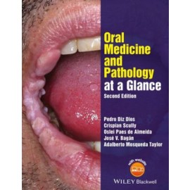 Oral Medicine and Pathology at a Glance, 2e