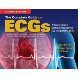 The Complete Guide to ECGs 4E