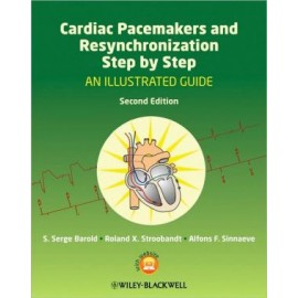 Cardiac Pacemakers and Resynchronization Step by Step: An Illustrated Guide, 2e