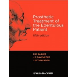 Prosthetic Treatment of the Edentulous Patient, 5e