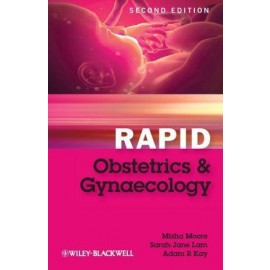 Rapid Obstetrics and Gynaecology 2e