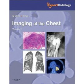 Imaging of the Chest, 2-Volume Set, Expert Radiology Series