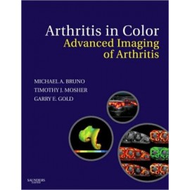 Arthritis in Color: Advanced Imaging of Arthritis
