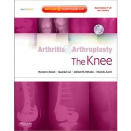 Arthritis and Arthroplasty: The Knee: Expert Consult: Online, Print and DVD