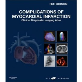 Complications of Myocardial Infarction, Clinical Diagnostic Imaging Atlas with DVD