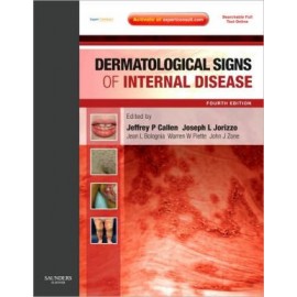 Dermatological Signs of Internal Disease, 4e