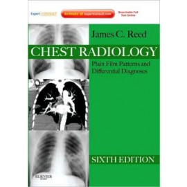 Chest Radiology, 6th Edition