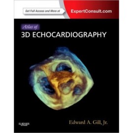 Atlas of 3D Echocardiography, 2e