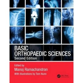 Basic Orthopaedic Sciences: The Stanmore Guide, 2e