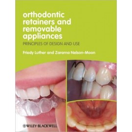 Removable Orthodontic Appliances and Retainers