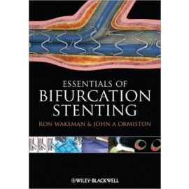 Bifurcation Stenting