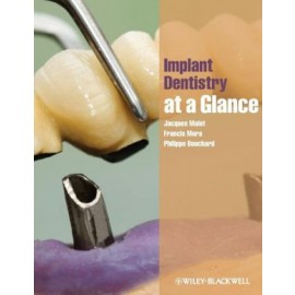 Implant Dentistry At A Glance