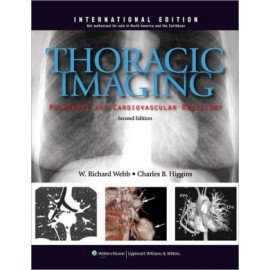 Thoracic Imaging: Pulmonary and Cardiovascular Radiology IE, 2e