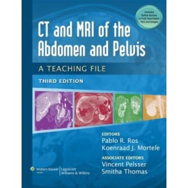 CT & MRI of the Abdomen and Pelvis: A Teaching File, 3e