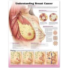 Understanding Breast Cancer Chart 3E