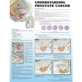 Understanding Prostate Cancer Chart 2e
