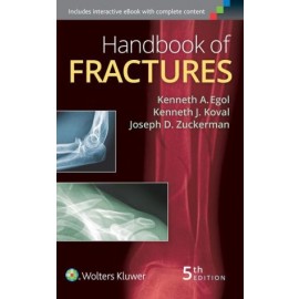 Handbook of Fractures, 5e