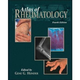 Atlas of Rheumatology, 4e