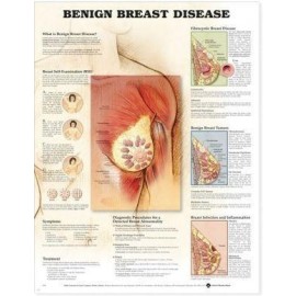 Benign Breast Disease Chart