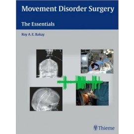 Movement Disorder Surgery