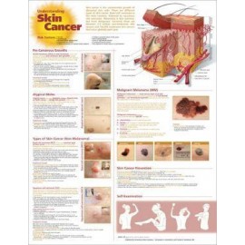 Understanding Skin Cancer Chart 2E