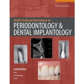Hall's Critical Decisions in Periodontology, 5e