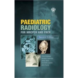 Paediatric Radiology for MRCPCH and FRCR, 2e