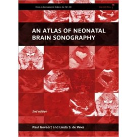 An Atlas of Neonatal Brain Sonography: (CDM 182-183), 2e