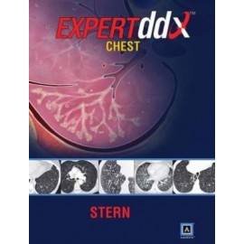 EXPERTddx: Chest