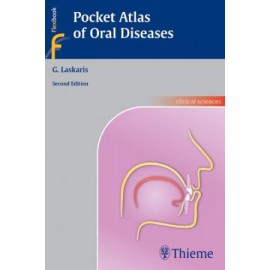 Pocket Atlas of Oral Diseases, 2e