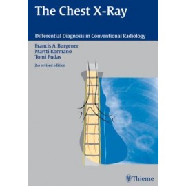 The Chest X-Ray, 2E