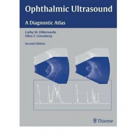 Ophthalmic Ultrasound