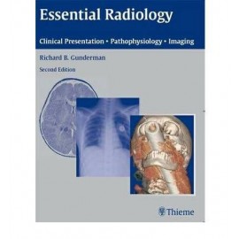 Essential Radiology: Clinical Presentation Pathophysiology Imaging