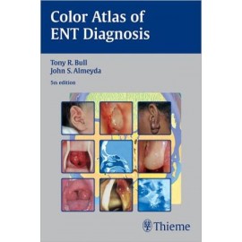 Color Atlas of ENT Diagnosis