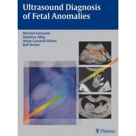 Ultrasound of Fetal Anomalies