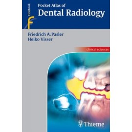 Pocket Atlas of Dental Radiology