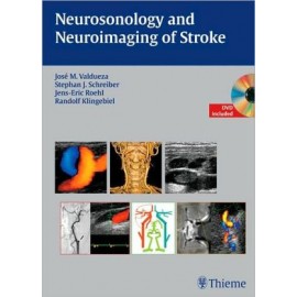 Neurosonology and Neuroimaging of Stroke, Book & DVD