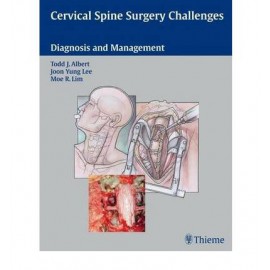 Cervical Spine Surgery Challenges