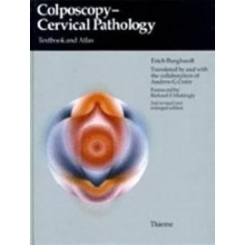 Colposcopy, Cervical Pathology, 3e