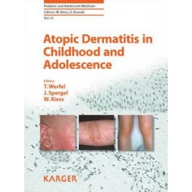Atopic Dermatitis in Childhood and Adolescence (Pediatric and Adolescent Medicine)
