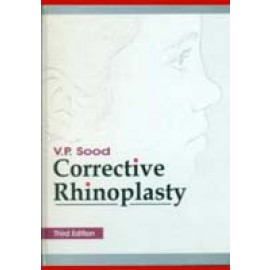 Corrective Rhinoplasty, 3e (HB)