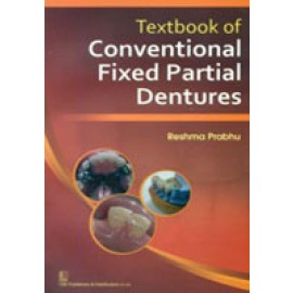 Textbook of Conventional Fixed Partial Dentures
