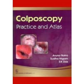 Colposcopy—Practice and Atlas