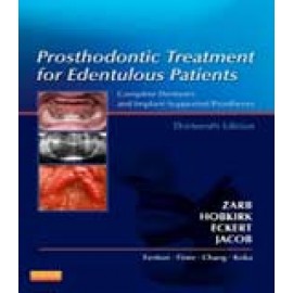 Prosthodontic Treatment for Edentulous Patients, 13/e
